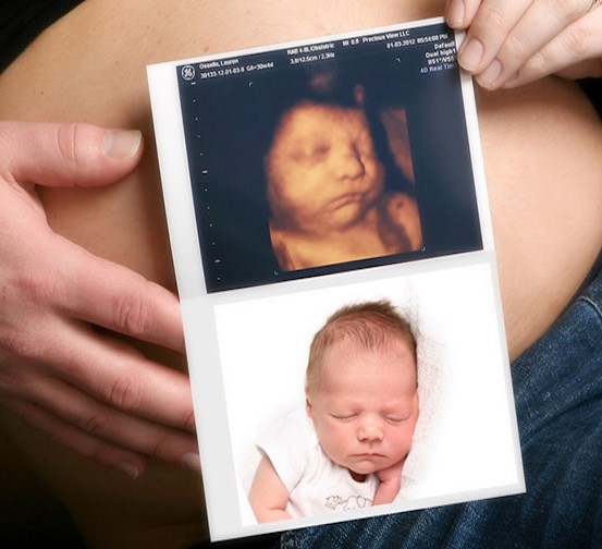 Siêu âm thai 5D an toàn cho cả mẹ và bé