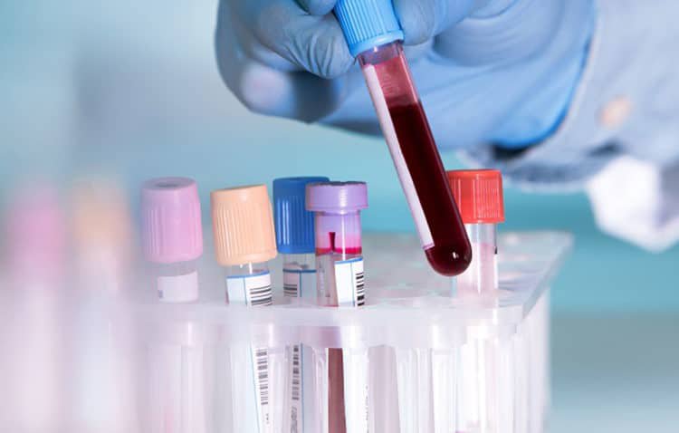 Xét nghiệm máu giúp  phát hiện ra nhiều bệnh truyền nhiễm