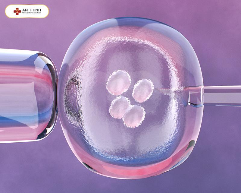 IVF là kỹ thuật hỗ trợ sinh sản hiện đại