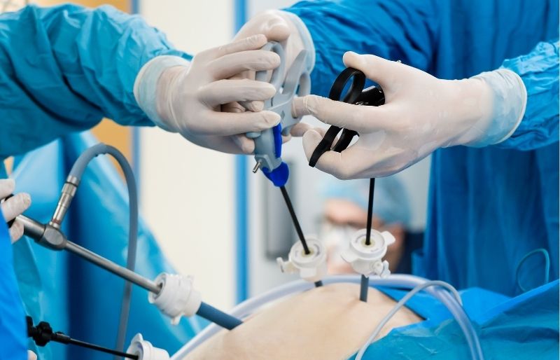 Phương pháp phẫu thuật nội soi