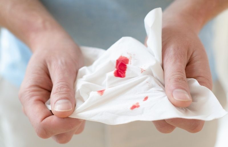 Ra máu âm đạo bất thường