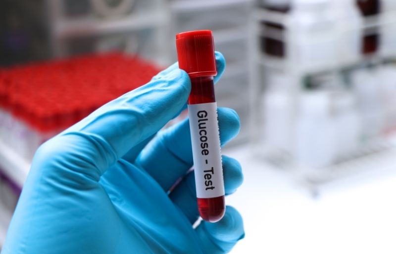Xét nghiệm Glucose máu