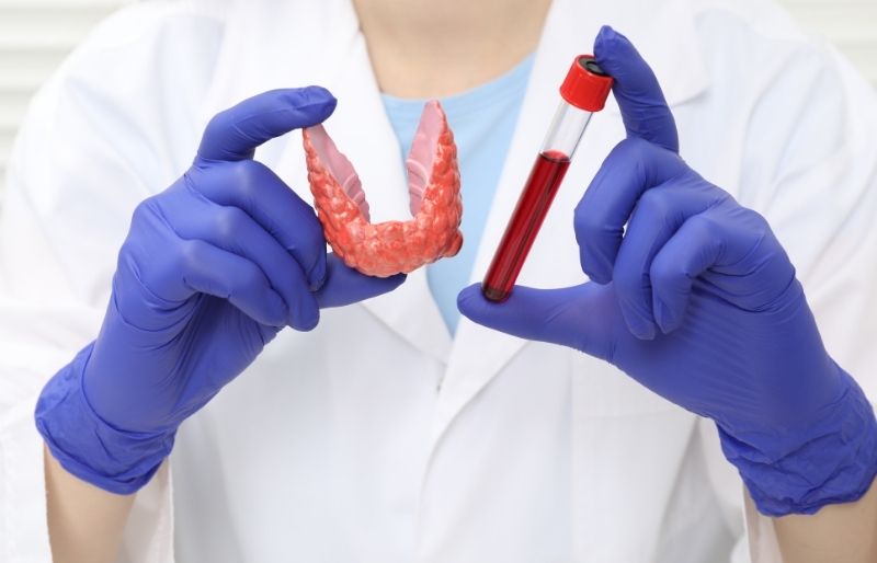 Xét nghiệm tuyến giáp