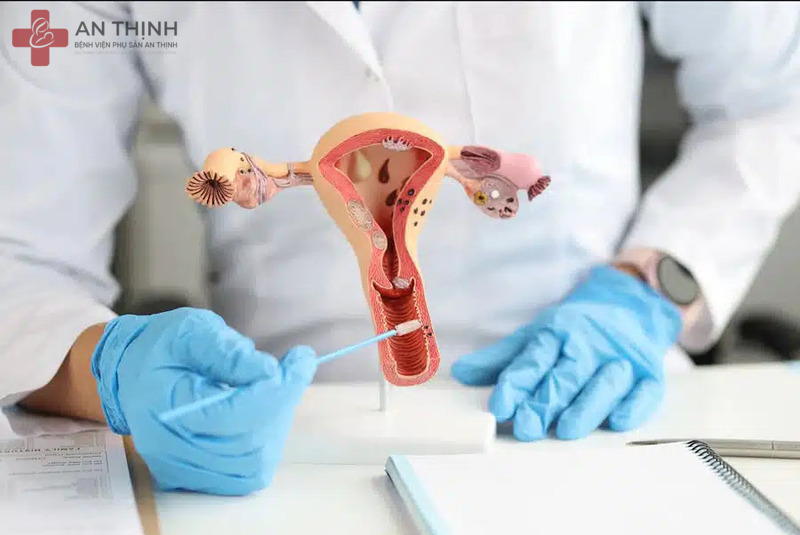 Kiểm tra tử cung giúp xác định tình trạng và phát hiện sớm các bệnh lý bất thường