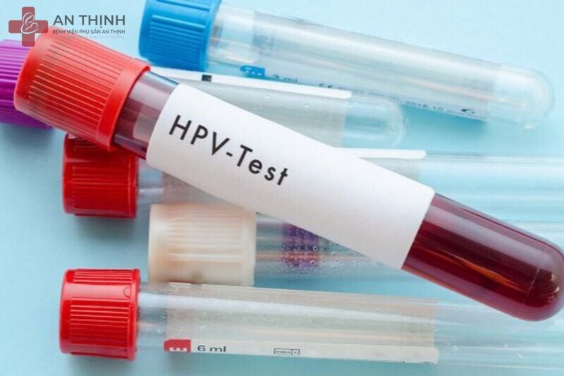 Xét nghiệm HPV giúp phát hiện sớm virus gây ung thư cổ tử cung và bệnh lây truyền khác