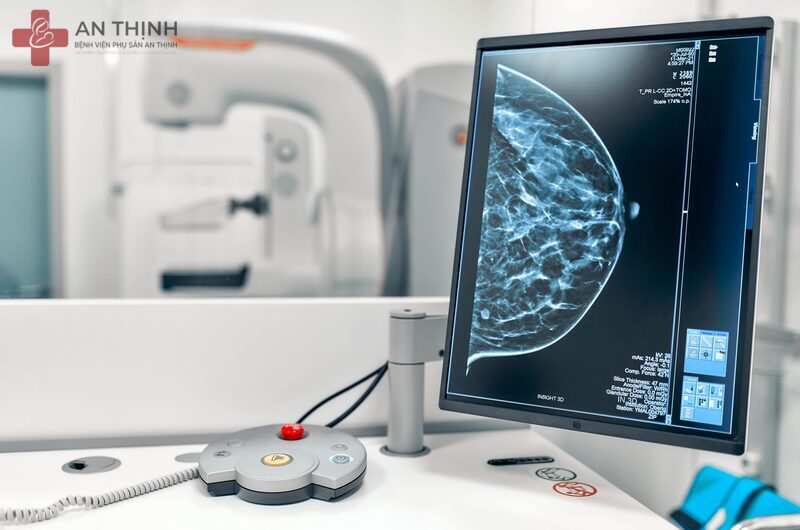 Chụp nhũ ảnh tuyến vú giúp phát hiện sớm ung thư và các bất thường trong mô vú