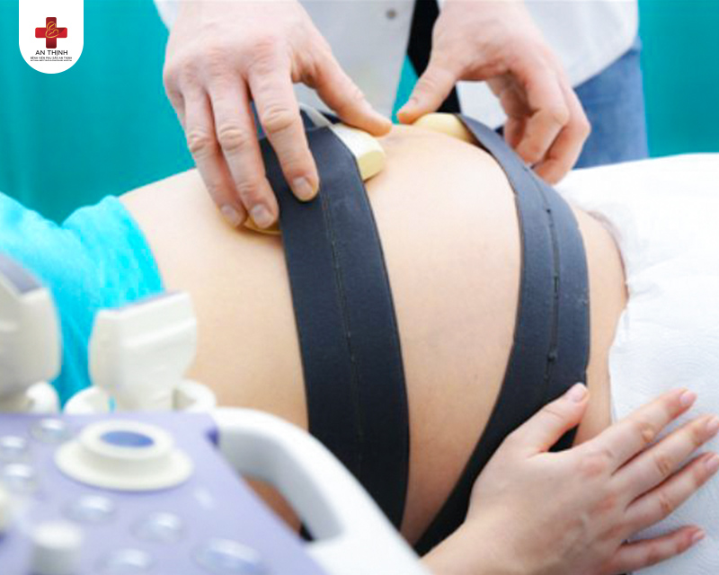 Xét nghiệm Non – stress nhằm kiểm tra sức khỏe của thai nhi, kiểm tra xem bé có nhận đủ nguồn oxy từ mẹ hay không (ảnh internet)