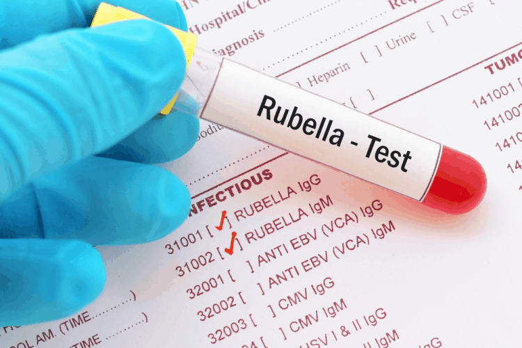 Xét nghiệm Rubella IgM và IgG giúp nhanh chóng tìm ra kháng thể Rubella IgM và Rubella IgG ở mẹ bầu