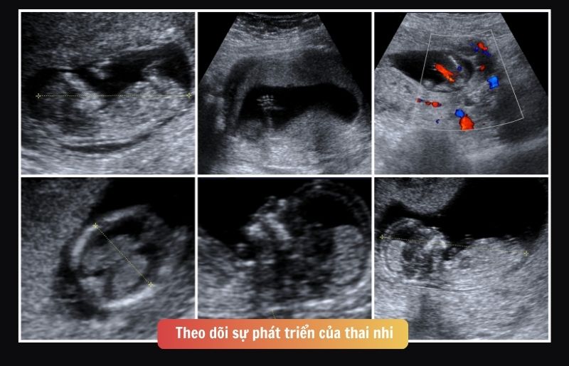 Theo dõi sự phát triển của thai nhi Theo dõi sự phát triển của thai nhi