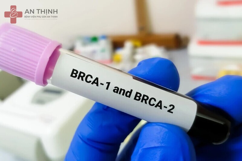 Người có tiền sử bệnh vú hoặc đột biến gen BRCA1 BRCA2 có nguy cơ ung thư vú cao