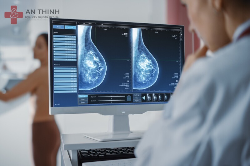 Chụp X quang tuyến vú giúp phát hiện sớm ung thư với quy trình nhanh và không xâm lấn