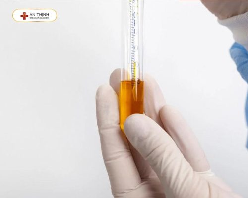 Màu nước tiểu thay đổi khi có thai
