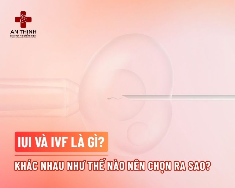 IUI và IVF là gì? Khác nhau thế nào và nên chọn ra sao?