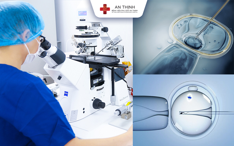 Piezo ICSI và Magic RS: Bộ đôi giúp tăng tỷ lệ thụ tinh thành công 