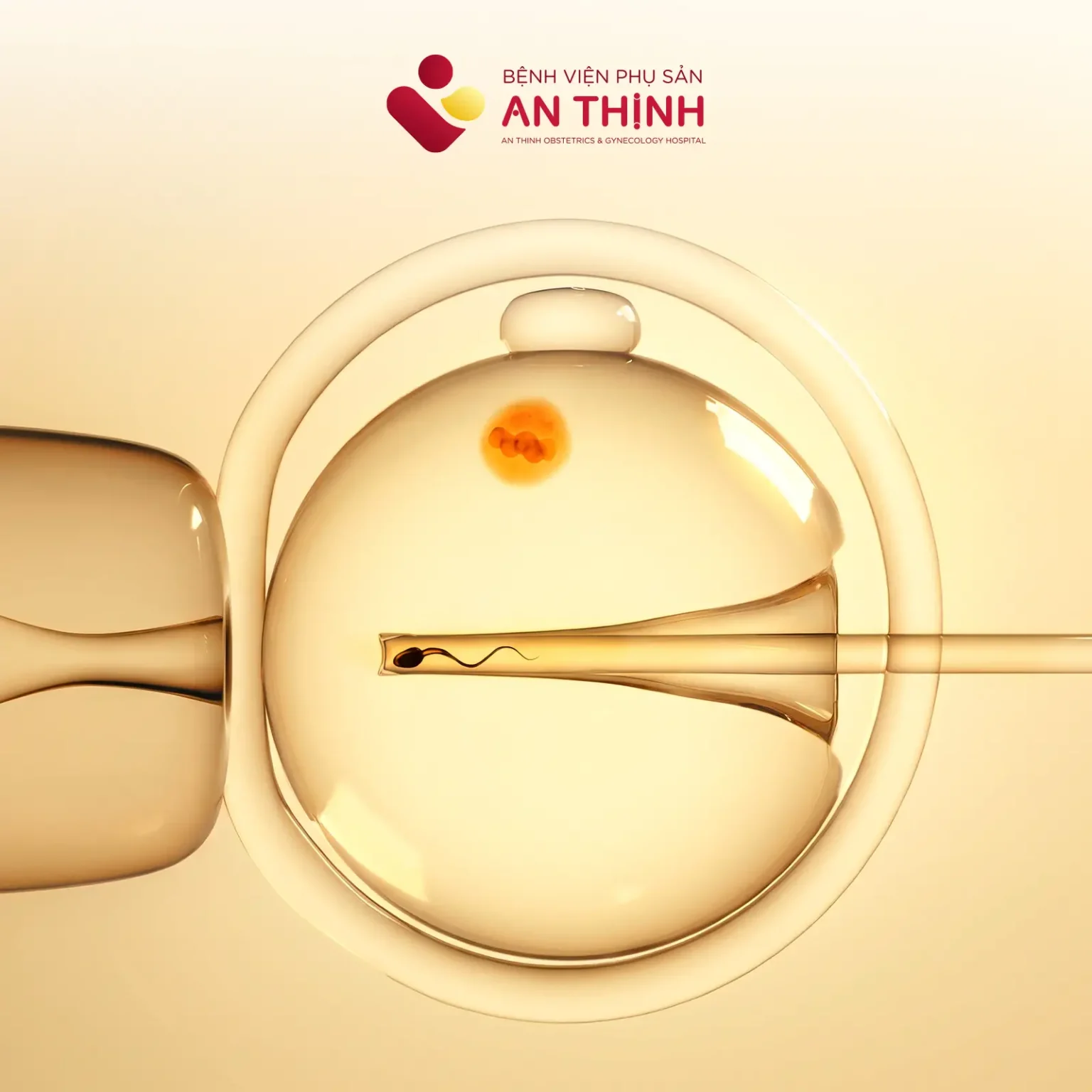 H1 Thụ tinh ống nghiệm IVF
